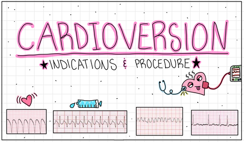 Cardiac Flash Cards (DIGITAL)