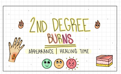 Emergency & Burns Flash Cards (DIGITAL)